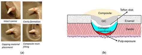 Dentin:  Un matériau biocompatible extraordinaire pour les applications dentaires et osseuses!